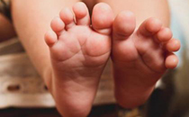 儿童脚黄是什么原因 儿童脚底发黄正常吗
